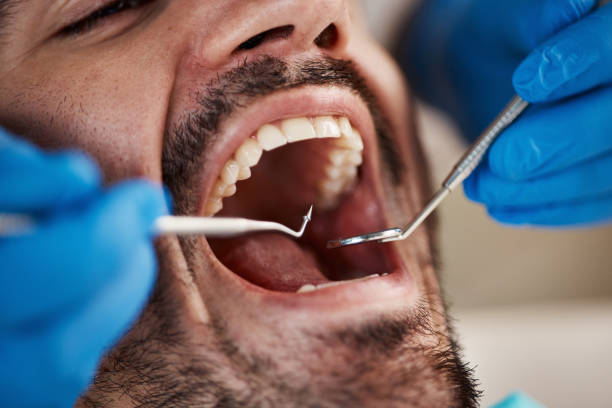 Best Orthodontic Emergency Dentist in Spanish Fort, AL