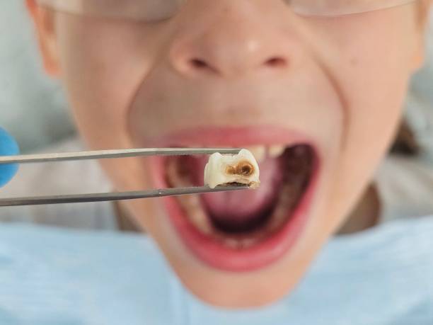 Best Weekend Emergency Dentist in Spanish Fort, AL